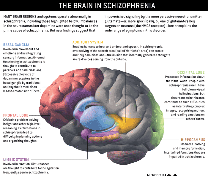 schizophrenia brain